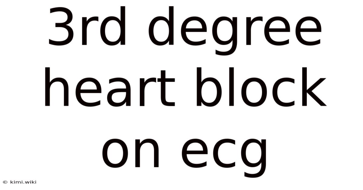 3rd Degree Heart Block On Ecg